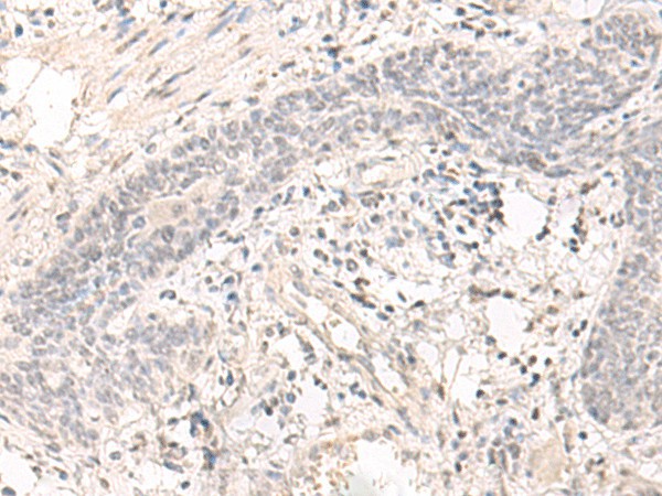 SAP130 Polyclonal Antibody (E-AB-52660)