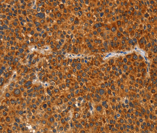 IKZF3 Polyclonal Antibody (E-AB-10975)