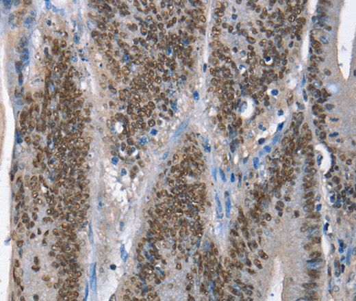 GNRH1 Polyclonal Antibody (E-AB-14190)