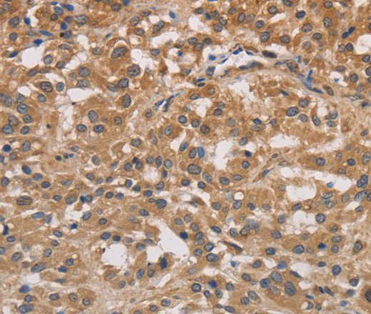 DSTN Polyclonal Antibody (E-AB-14950)