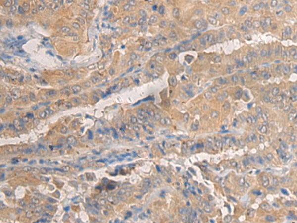 AGAP3 Polyclonal Antibody (E-AB-19694)