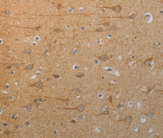 SLC4A7 Polyclonal Antibody (E-AB-12639)
