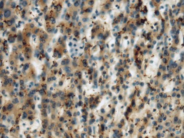 MICA Polyclonal Antibody (E-AB-18241)