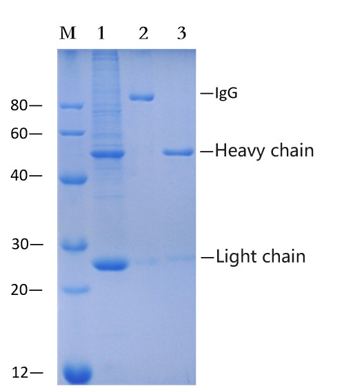 Protein A Magnetic beads (EA-IP-015M)