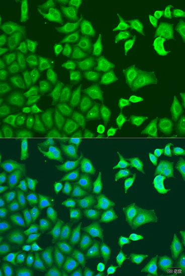 CAPZB Polyclonal Antibody (E-AB-62652)
