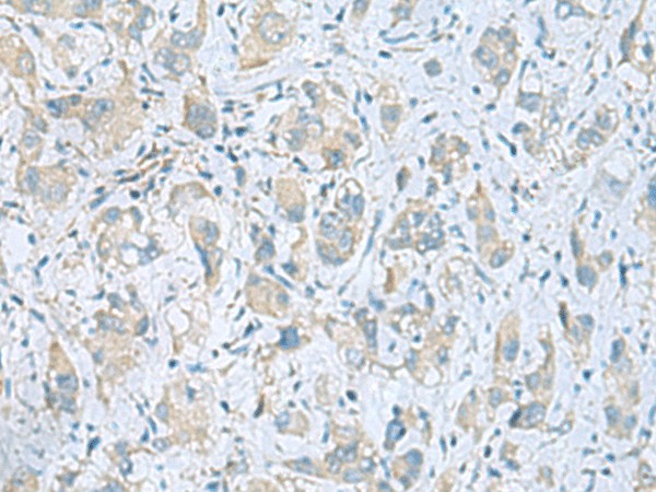 PLN Polyclonal Antibody (E-AB-19885)