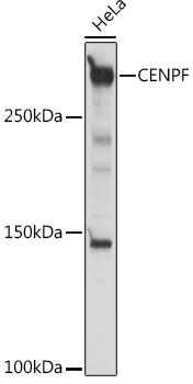 CENPF Polyclonal Antibody (E-AB-92105)
