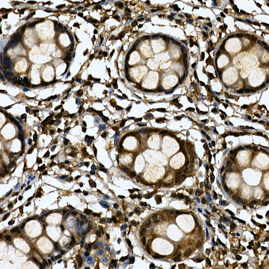 TNKS1BP1 Polyclonal Antibody (E-AB-92235)