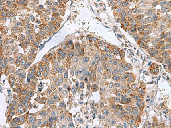 NFS1 Polyclonal Antibody (E-AB-19153)