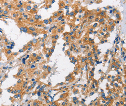 CHMP1A Polyclonal Antibody (E-AB-11080)