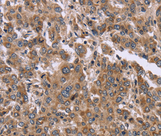 FAM3B Polyclonal Antibody (E-AB-15013)