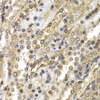 NEDD9 Polyclonal Antibody (E-AB-60709)