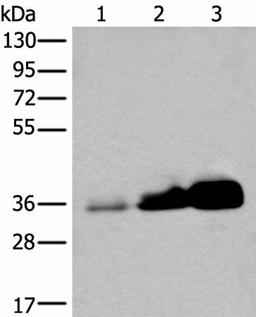 UBE2Z Polyclonal Antibody (E-AB-18434)