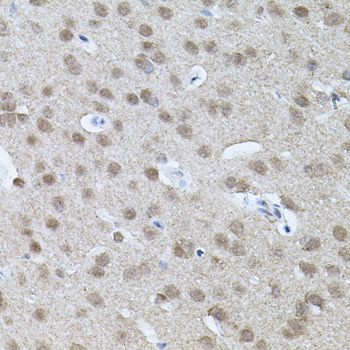 RNF166 Polyclonal Antibody (E-AB-63875)