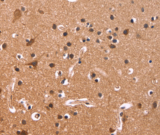 CSNK1D Polyclonal Antibody (E-AB-11107)