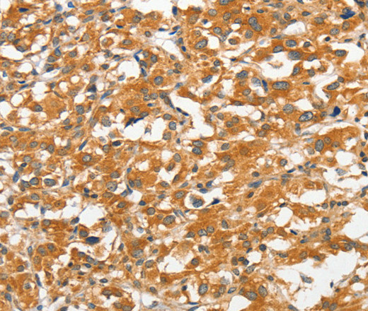 ANKMY2 Polyclonal Antibody (E-AB-14569)