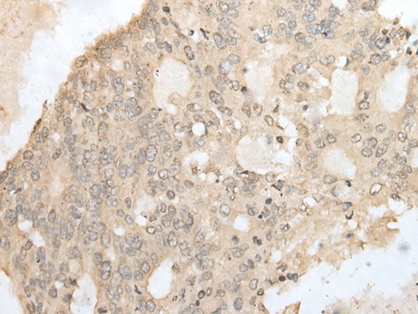 ZZZ3 Polyclonal Antibody (E-AB-18477)