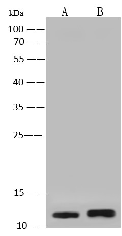 S100A2 Monoclonal Antibody (AN200096P)