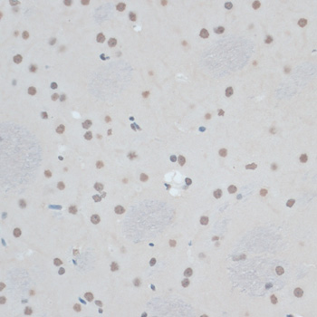 ZNF433 Polyclonal Antibody (E-AB-66374)
