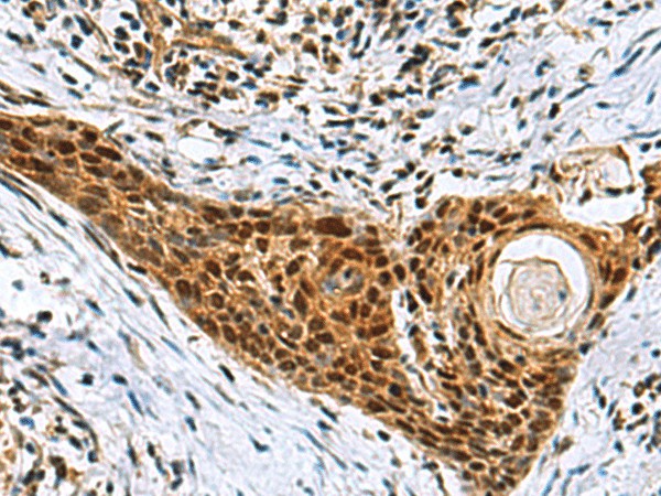 NABP1 Polyclonal Antibody (E-AB-19167)