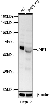 (KO Validated) IGF2BP1/IMP1 Polyclonal Antibody (E-AB-92453)