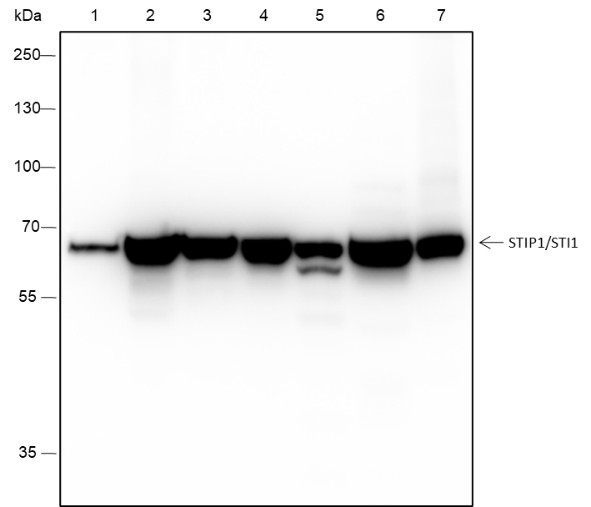 Recombinant STIP1/STI1 Monoclonal Antibody (AN301667L)