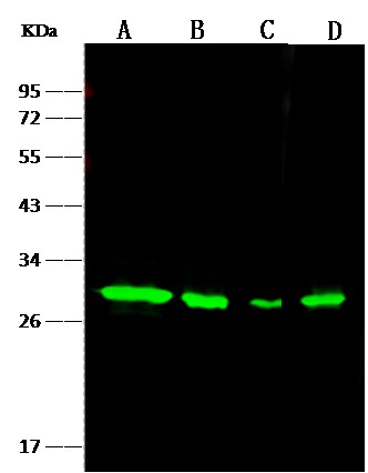 Recombinant NQO1 Monoclonal Antibody (AN300158P)