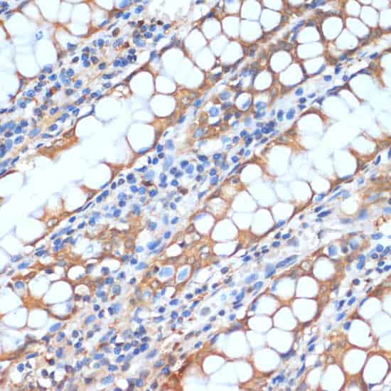 HHLA2 Polyclonal Antibody (E-AB-66037)