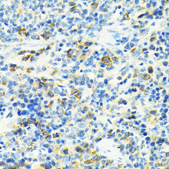 SLC25A11 Polyclonal Antibody (E-AB-65573)
