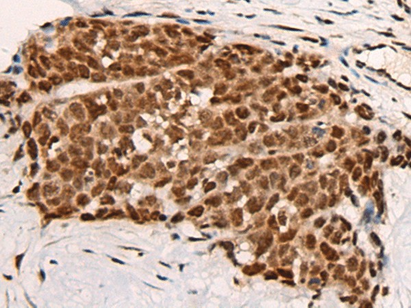 HGH1 Polyclonal Antibody (E-AB-17755)