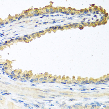 COCH Polyclonal Antibody (E-AB-61215)