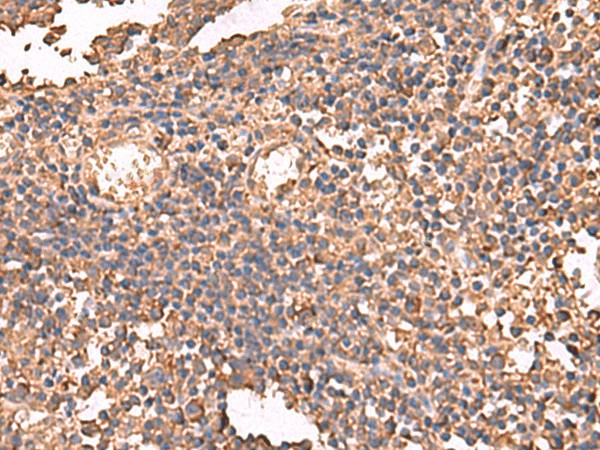 LDHAL6B Polyclonal Antibody (E-AB-19011)