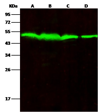 Recombinant PTP1B/PTPN1 Monoclonal Antibody (AN300317P)