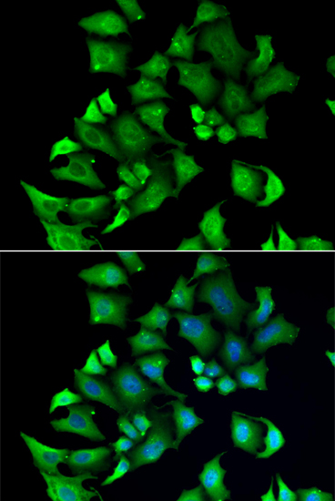 ENTPD2 Polyclonal Antibody (E-AB-61229)
