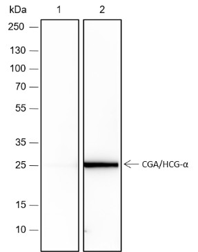 Recombinant CGA/hCG alpha Monoclonal Antibody (AN301490L)