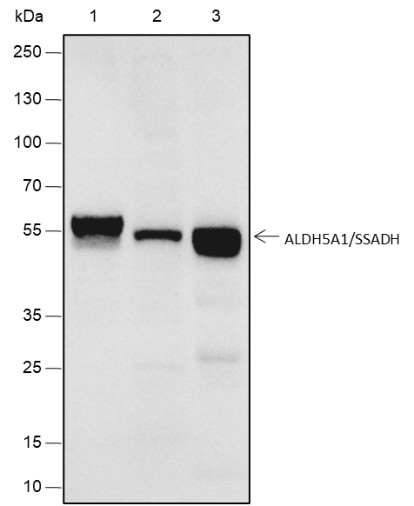 Recombinant ALDH5A1/SSADH Monoclonal Antibody (AN301828L)