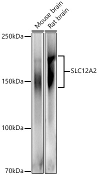 SLC12A2 Polyclonal Antibody (E-AB-90289)