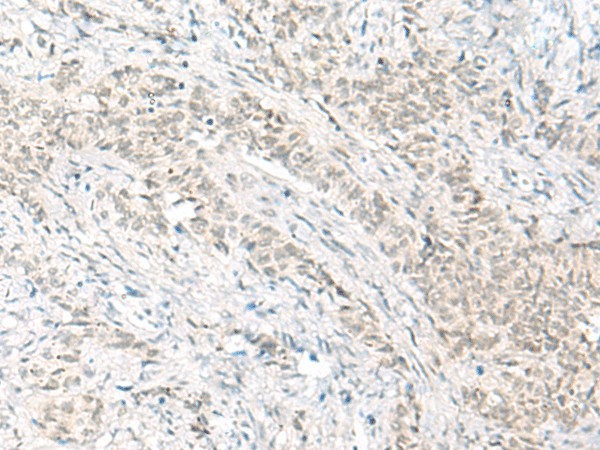 HABP4 Polyclonal Antibody (E-AB-18066)