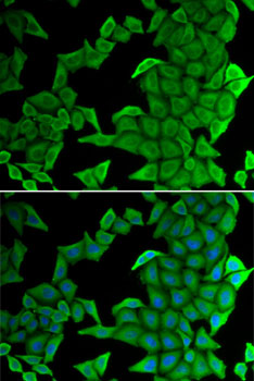 SMYD2 Polyclonal Antibody (E-AB-61990)