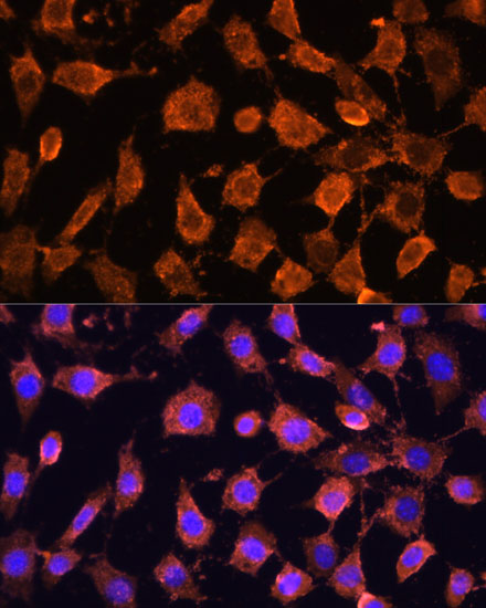 RPL11 Polyclonal Antibody (E-AB-61940)