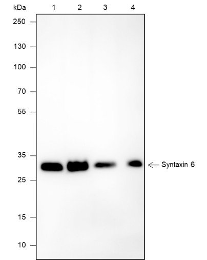 Recombinant Syntaxin 6 Monoclonal Antibody (AN301919L)