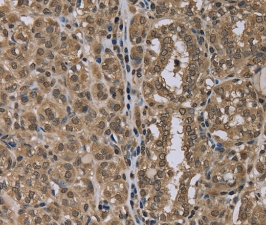 NLRP6 Polyclonal Antibody (E-AB-16629)