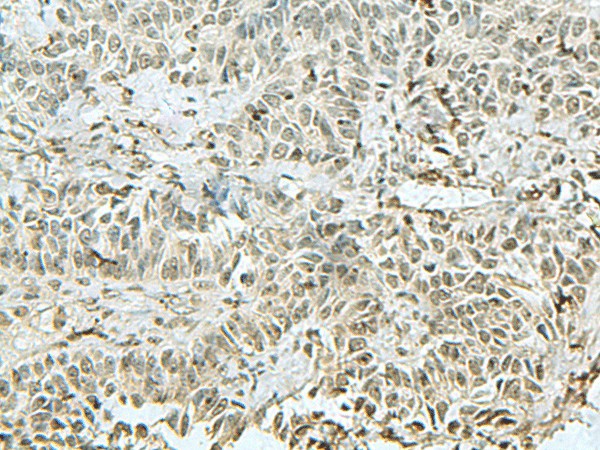 THTPA Polyclonal Antibody (E-AB-52864)
