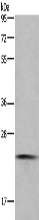 CMTM6 Polyclonal Antibody (E-AB-15669)
