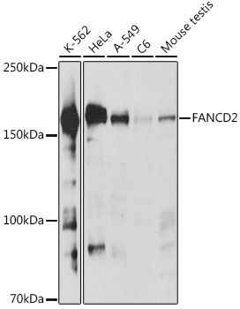 FANCD2 Polyclonal Antibody (E-AB-92145)
