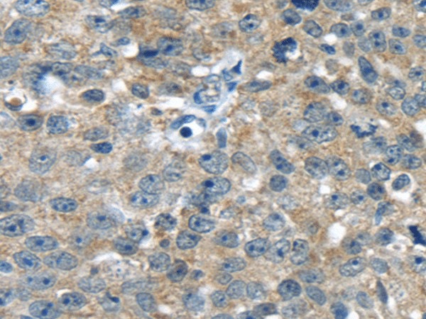 PBOV1 Polyclonal Antibody (E-AB-17415)