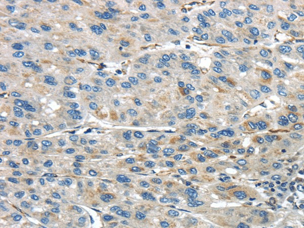 IQGAP2 Polyclonal Antibody (E-AB-17344)