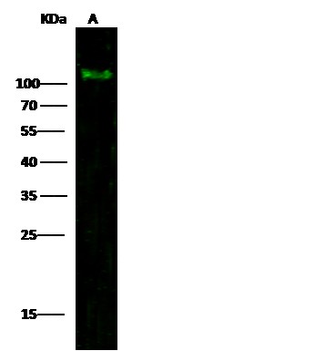 PDGFRA/CD140a Monoclonal Antibody (AN200022P)