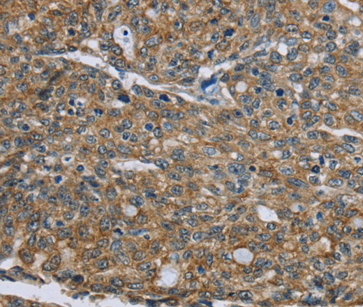 CK-5 Polyclonal Antibody (E-AB-10147)