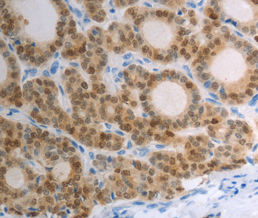 S100A1 Polyclonal Antibody (E-AB-12634)